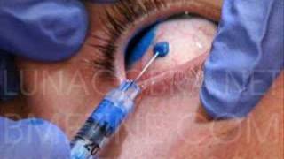 Eye Tattoo