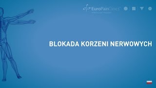 BLOKADA KORZENI NERWOWYCH