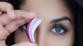 মুখের সব কালো দাগ দূর করবে পেঁয়াজ দেখুন