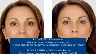 Watch Фотоэпиляция:Фотоэпиляция Лица,Ног,Подмышек,Зоны Бикини. - Фотоэпиляция Бикини