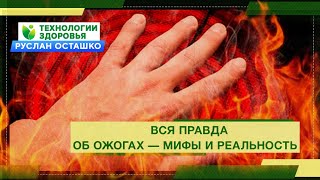 Вся правда об ожогах - мифы и реальность