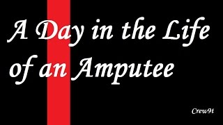 A Day in the Life of an Amputee