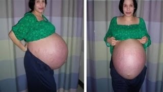 10 САМЫХ НЕВЕРОЯТНЫХ СЛУЧАЕВ МАТЕРИНСТВА