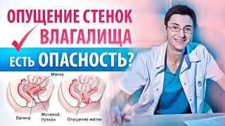 Опущение стенок влагалища. Опасно ли это?. Дубинская Е.Д.