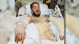 Marine Who Lost Limbs in Middle East Explosion Gets Double Arm Transplant