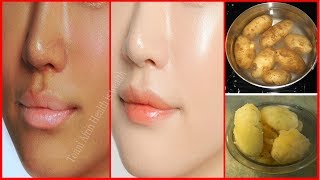 রূপচর্চায় আলু দিয়ে কয়েকটি ফেসপ্যাক! ত্বক ফর্সা ও উজ্জ্বল করুন ঘরে বসে! beauty tips in bengali