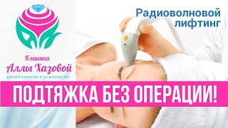 Подтяжка лица без операции! Фракционный RF-лифтинг. Коррекция овала лица. Радиоволновой лифтинг.