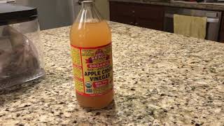 Eye Stye - natural treatments for stye - natural home remedy for Stye