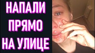 На GTFOBAE Напали Прямо На Улице В Москве