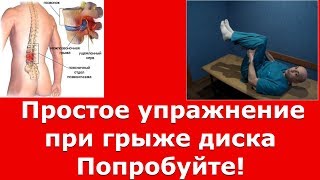 Как вылечить  грыжу диска легко и без уколов! #грыжная техника#