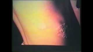 4.1. Semiología Médica de Lasala: El examen físico del abdomen 3/3