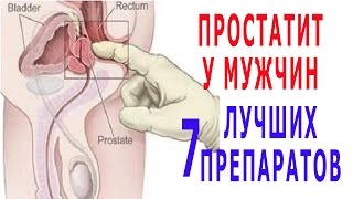 ★ ПРОСТАТИТ У МУЖЧИН. 7 лучших препаратов от АДЕНОМЫ предстательной железы.
