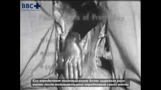 Обследование половых органов коровы. Часть 3. Определение стельности