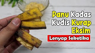 KATAKAN SELAMAT TINGGAL PADA SEMUA JENIS GATAL PADA KULIT DENGAN CARA YANG SANGAT MUDAH | SEHAT TUBE
