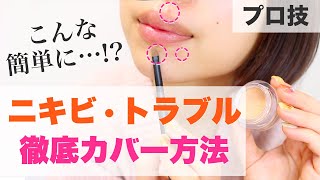 本当の【大人ニキビの隠し方】プロが実践する