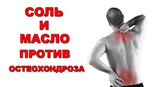 Остеохондроз. Лечение остеохондроза позвоночника. Шейный остеохондроз.
