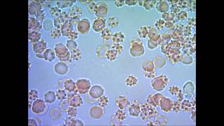 Кровь человека под микроскопом under microscope