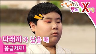삐뽀삐뽀! 우리 몸 X파일 - 다래끼가 났어요_#001