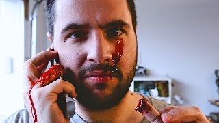 Tétanos | La Légende du doigt coupé