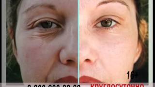Аппарат для разглаживания морщин Дерма Ванд (Derma Wand)