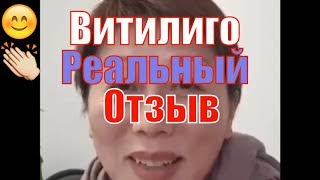 Витилиго - реальный отзыв о лечении витилиго без фотошопа! Белые пятна на коже. Купить Elev8.