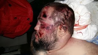 Эрика Давидыча убивают в Сизо (16 марта час ночи)