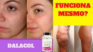 Dalacol Funciona?Dalacol é Bom?Dalacol Onde Comprar?Dalacol Funcioana Mesmo? TUDO SOBRE O DALACOL!