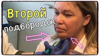 Второй ПОДБОРОДОК. Как УБРАТЬ ВТОРОЙ ПОДБОРОДОК. МЕЗОТЕРАПИЯ. Липолитики. Мастеркласс Е.Ранневой