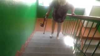 Amputee. Amputierte