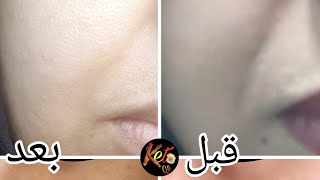 تأثير نظام الكيتو على البشرة