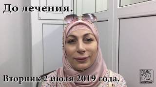 810. ТРОЙНИЧНЫЙ НЕРВ и метод RANC. Отзыв после 1 пятидневного курса лечения.