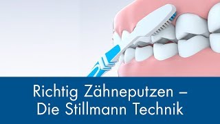 Richtig Zähneputzen - Die Stillmann Technik
