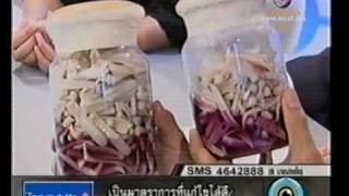 ศัลยกรรมกับหมอชลธิศ ตอนที่1