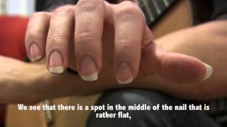 Guitar Technique : Ongles/Nails - Thomas Viloteau