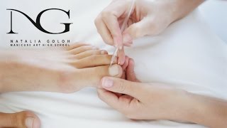Тампонада вросшего ногтя: классический педикюр. Periscope / Tamponade ingrown nail: classic pedicure