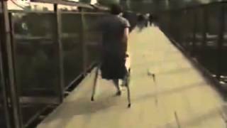Amputee Love Amputee Women Who Are The Joy Of Lİfe 141 New Video