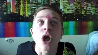 Как же я обожаю прыщи!