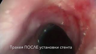 Коллапс трахеи. Собака Клайд.