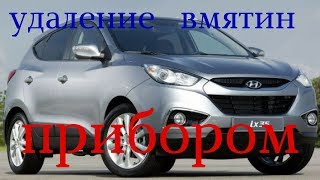 удаление вмятин прибором  Hyundai ix35