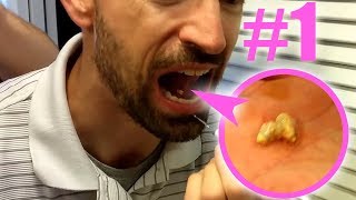 ТОП СОЧНЫЕ ОГРОМНЫЕ ЧЕРНЫЕ ТОЧКИ, ПРЫЩИ, УДАЛЕНИЕ
