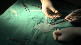 Cystocele and stress urinary incontinence synthetic repair using a self-tailored polypropylene mesh