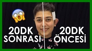 20 DAKİKADA KEPÇE KULAK AMELİYATI OLDUM ! ??
