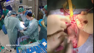 Disfunción Eréctil Implante protesi peneana Cirugía Uro-Andrología mínimamente invasiva