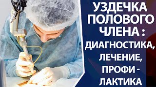 Уздечка полового члена