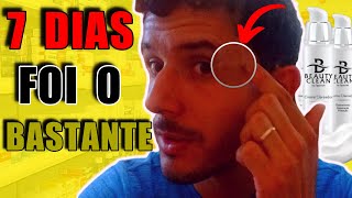 Beauty Clean Creme Clareador | Beauty Clean Funciona?Minha Experiência Com Beauty Clean Em 7 dias
