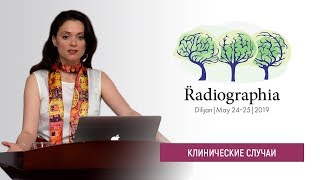 Ирина Трофименко. Когда звонит нейрохирург - подборка случаев