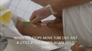 SELF CATHETERIZATION