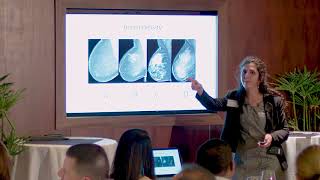 Update on Breast Cancer Screening Guidelines