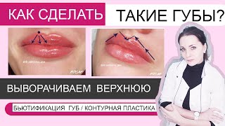 Как вывернуть верхнюю губу? Техника контурная пластика/ филлер