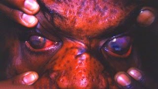 5 САМЫХ СТРАШНЫХ БОЛЕЗНЕЙ-УБИЙЦ ЧЕЛОВЕЧЕСТВА